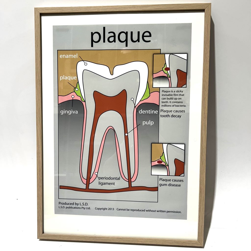 POSTER, Anatomical Framed A1 - PLAQUE