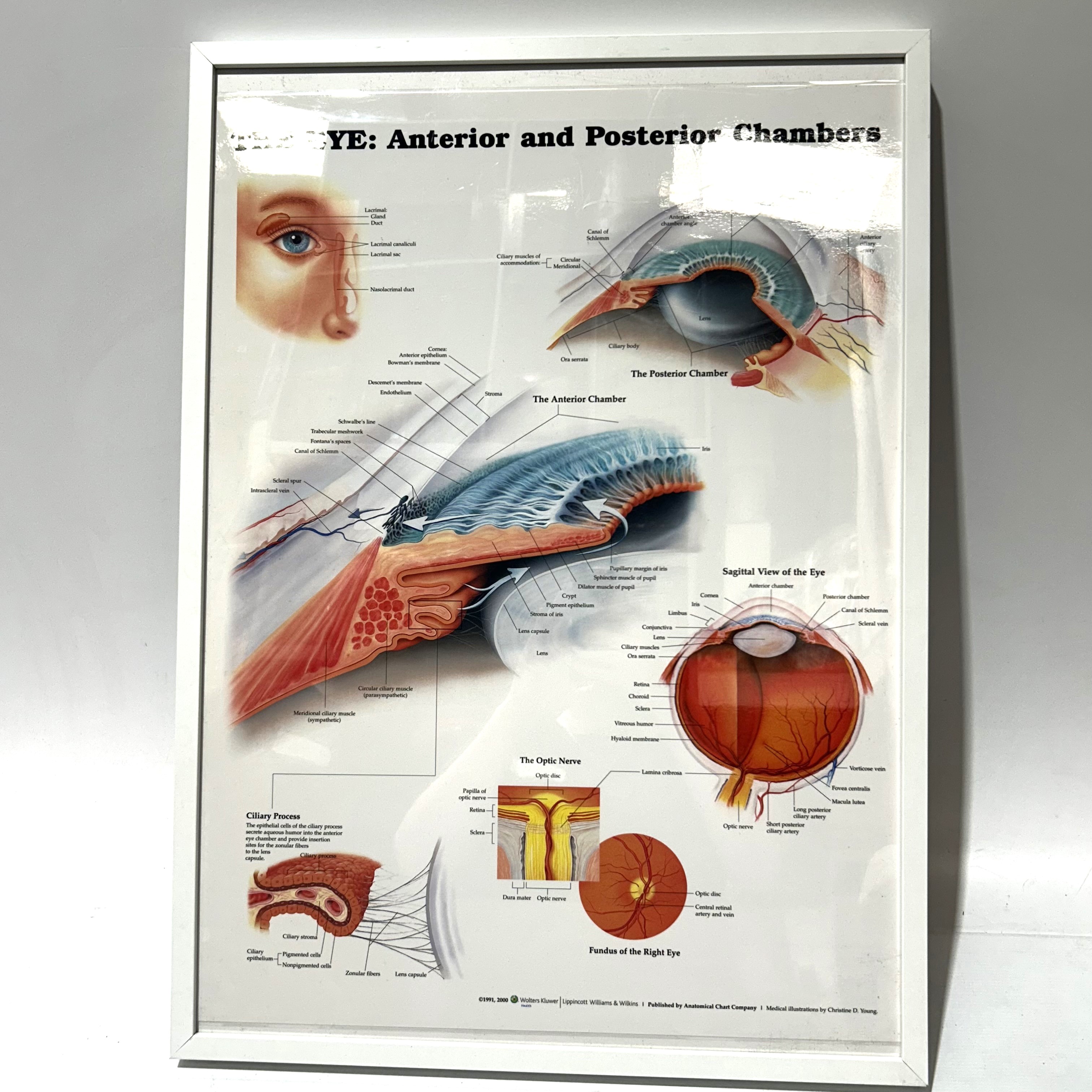 POSTER, Anatomical Framed A1 - THE EYE Anterior And Posteria